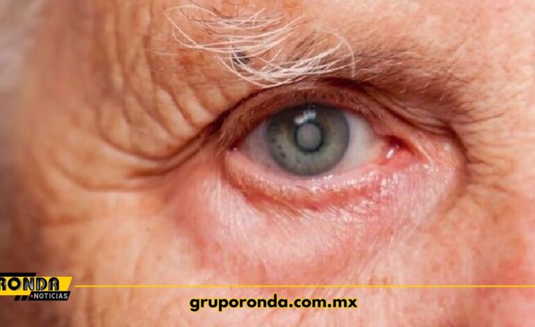  Cataratas y problemas de vista: tres vitaminas que necesitan tus ojos y en qué frutas encontrarlas