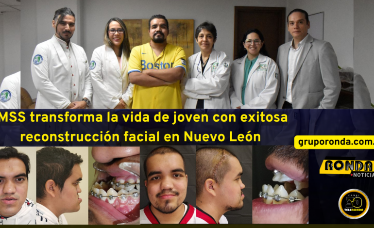 IMSS transforma la vida de joven con exitosa reconstrucción facial en Nuevo León
